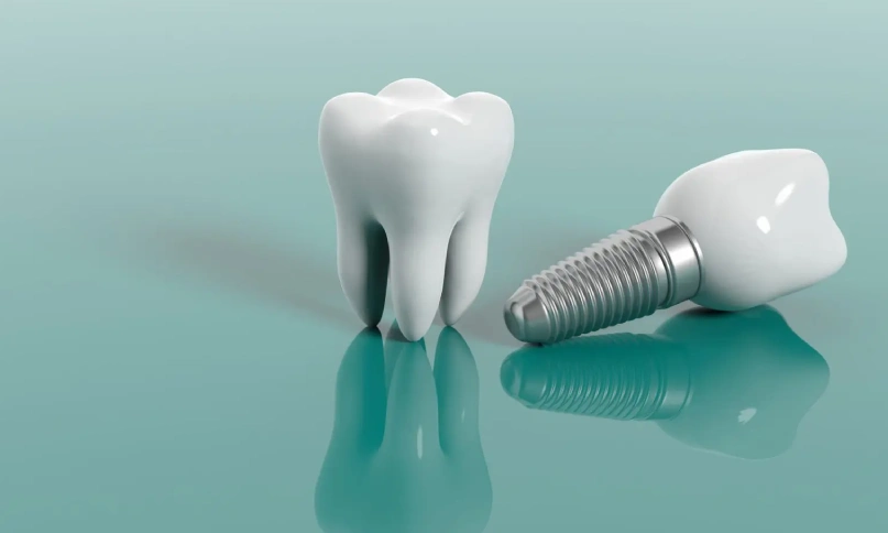 Dental Implants copy 3