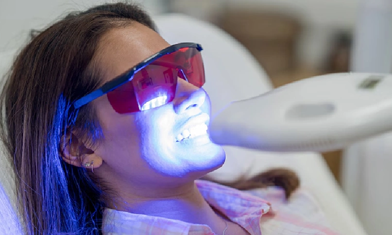 Teeth-Whitening